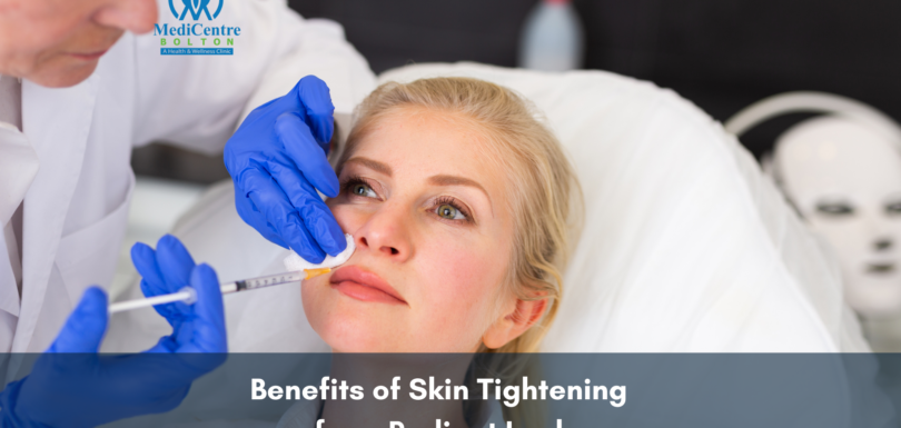 Benefits of Skin Tightening