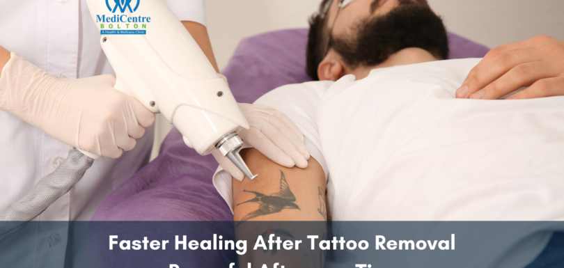 Faster Healing after Tattoo Removal