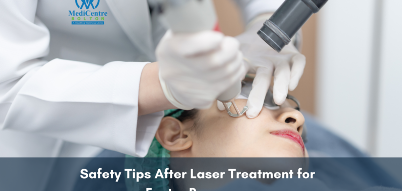 Safety tips after laser treatment