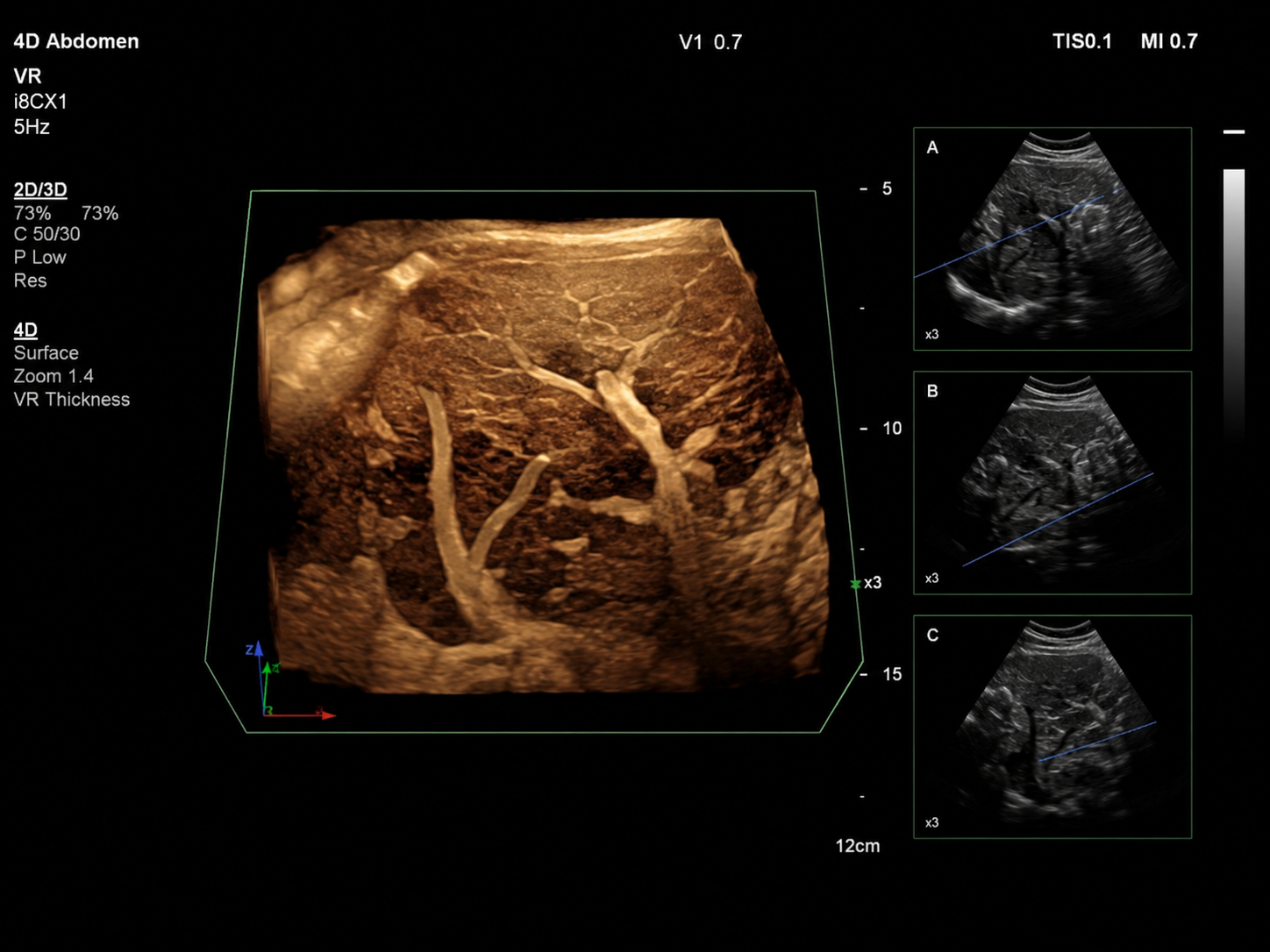 Abdominal ultrasound scan Bolton
