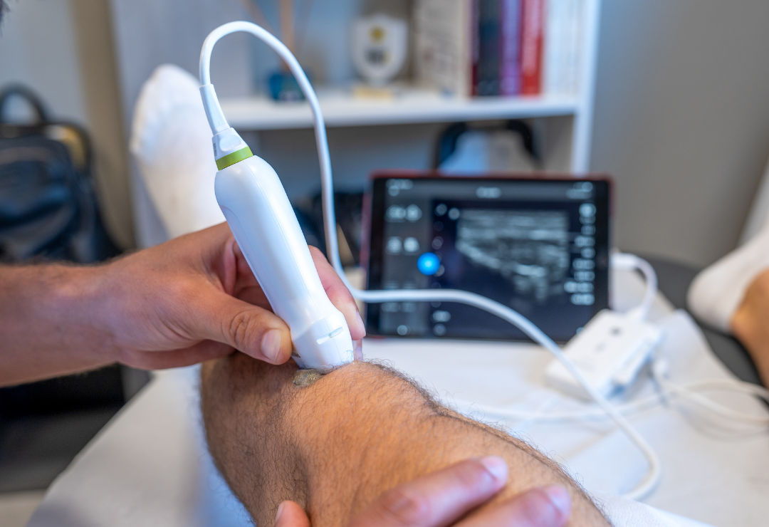 MSK musculoskeletal ultrasound Bolton